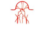 United Biologics - Model COW01V03 - Circle of Willis (With Aneurysms)