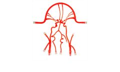 United Biologics - Model COW01V03 - Circle of Willis (With Aneurysms)
