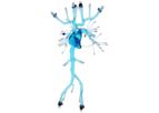 United Biologics - Model VCM09V01 - Patient Specific Pulmonary Embolism Model