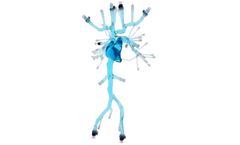 United Biologics - Model VCM09V01 - Patient Specific Pulmonary Embolism Model