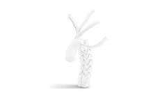 Artivion - Model E-vita Open Neo - Hybrid Stent Graft System
