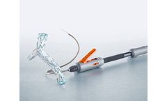 Artivion - Model E-liac - Stent Graft System