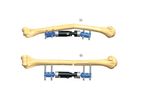 Orthofix - Model 1E.21 - Midshaft Deformity of Humerus In Children or Small Adults
