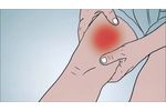 The Truth About Adverse Events - Video