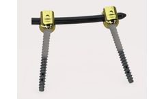 VADER - Model 6.0 - Pedicle Screw