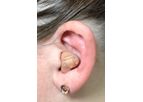 In-the-Ear (ITE) Device