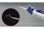BeBack - Introduction to the BeBack Crossing Catheter - Video