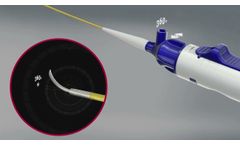 BeBack - Introduction to the BeBack Crossing Catheter - Video