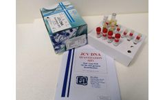 JCV DNA – PCR
