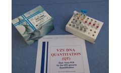 VZV DNA – PCR