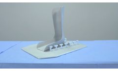 MPR Ortho - Updated Alvarado Total Knee System - Video