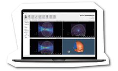 Brainbox - Model k-Plan - Ultrasound Therapy Planning System
