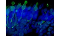 Retinal Organoids