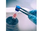 Disease Modelling Services