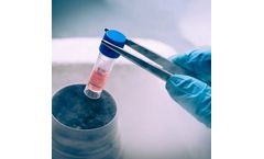 Disease Modelling Services