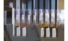 Model TubeEye - Blood Fractionation And Buffy Coat / Pbmc Extraction