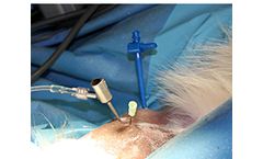 Cannuflow - Model ClearVu 2.7 - Flexible Inflow-Outflow Cannula