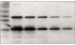 Tymora Analytical - Model 800 - pIMAGO HRP Detection on Western Blot (Complete Kit)