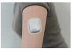 Nephria Bio - Wearable Bridge Therapy for AKI Treatment