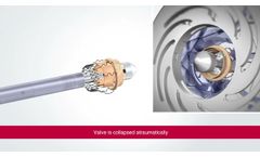 PERCEVAL IMPLANT TECHNIQUE ANIMATION - Video