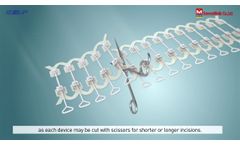 Ez Up Service Manual Sciencemedic Video