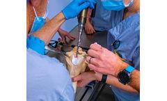 Arthroplasty