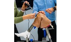Arthroscopy