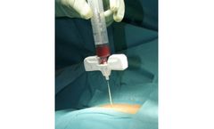 Busse - Bone Marrow Biopsy / Aspiration Needles