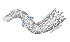 Tsunamed - Model NAVALIS ADVANCE - Peripheral Vascular Self-Expanding Stent System