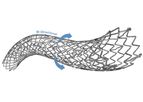 Tsunamed - Model NAVALIS-pp ADVANCE - Peripheral Vascular Self-Expanding Stent System