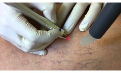 Besenreiserlaser V940 von V-Skin - Video