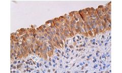 Santa Cruz Biotechnology, Inc. - Cdk4 Antibody (DCS-35)