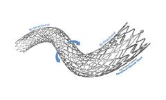 Stron - Model POLARIS ADVANCE - Peripheral Vascular Self-Expanding Stent System
