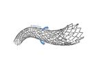 Stron - Model POLARIS-pp ADVANCE - Peripheral Vascular Self-Expanding Stent System