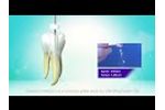 What is the advantages of MPro root canal files and how to use it - Video