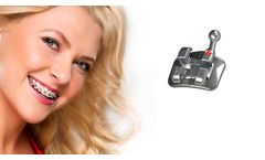 What Orthodontic Products Can IMD Provide - Video