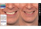 Intelliscan - 3D & Smile Creator App