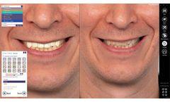Intelliscan - 3D & Smile Creator App