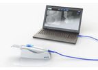 Viz - Intraoral Scanner