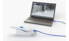 Viz - Intraoral Scanner