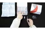 Pre-Eclampsia - Video