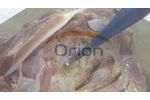 Electrosurgical unit Demo Video - ORION HA400 - Video