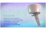 Radial Head Prosthesis - Video