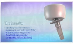 Radial Head Prosthesis - Video