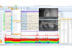 EEGStudio LTM Software