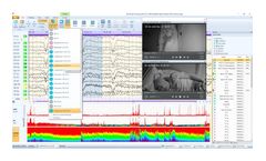 EEGStudio LTM Software