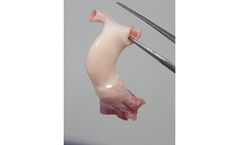 CenoValve-Cryopreserved