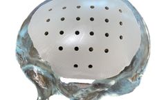Cranial Plates