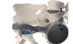Orthopedics