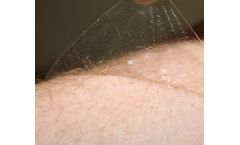 Scapa Soft-Pro - Model RX1449P - Low Trauma Silicone Gel Adhesive